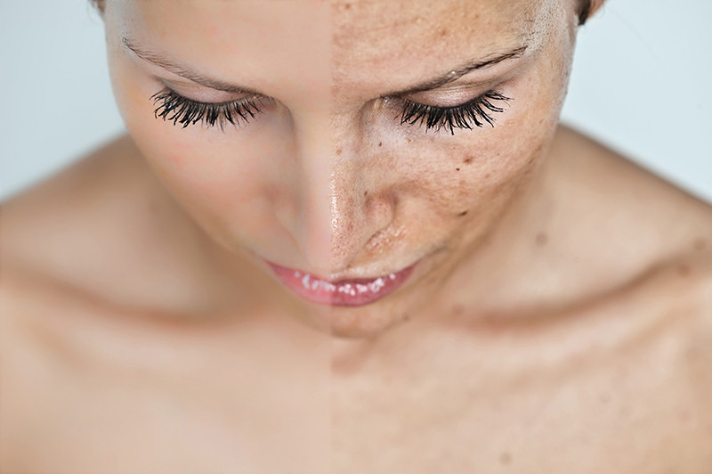 TRATTAMENTO VISO LUMINANT